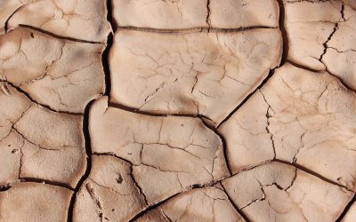 Ictiosis y patologías secas